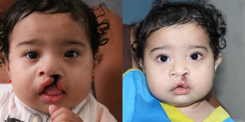 Austin Smiles - Sponsor a Child - photo Austin Smiles - Sponsor a Child - photo
