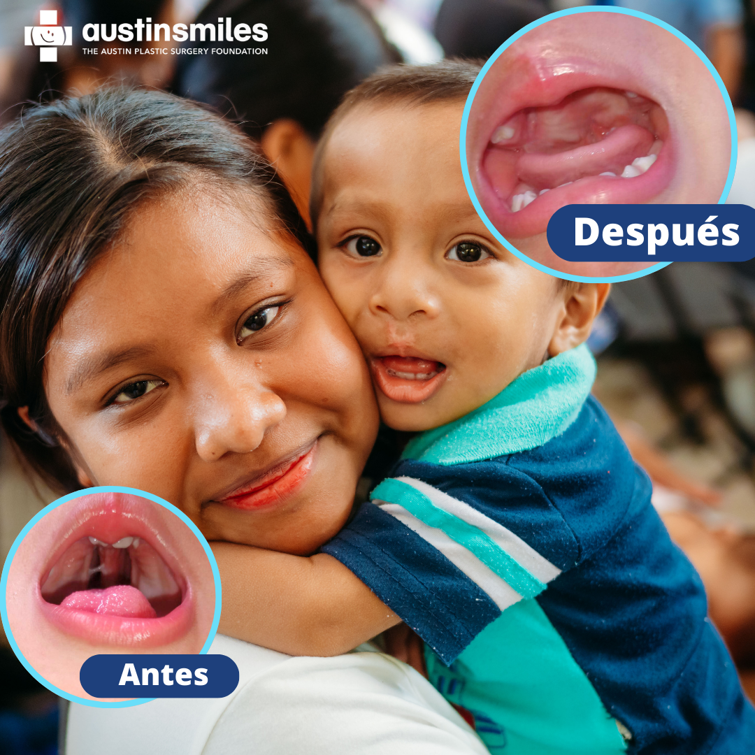 austin-smiles-medical-mission-trips-upcoming